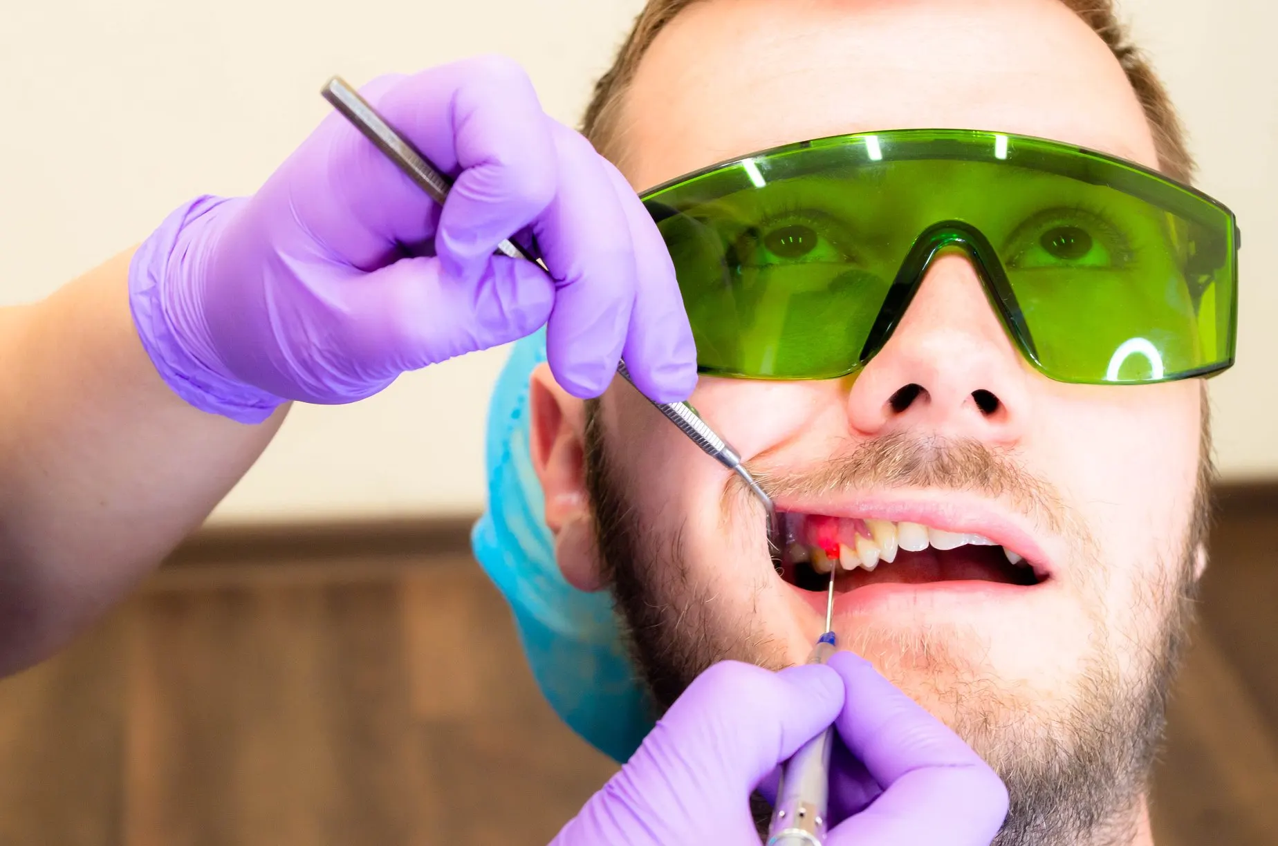 Cum este diagnosticata gingivita la Life Dental Spa?
