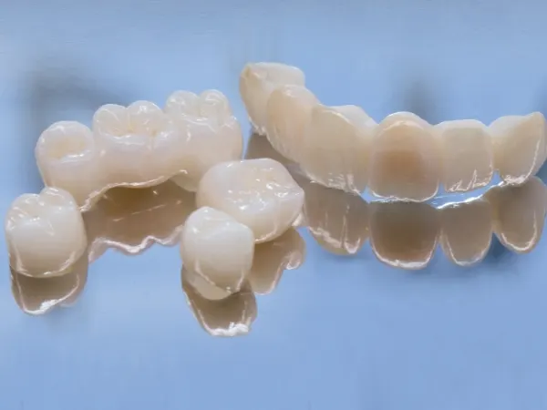 Cand este recomandat tratamentul cu coroana dentara?