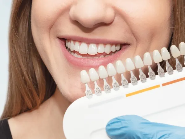 Coroane dentare inalt biocompatibile