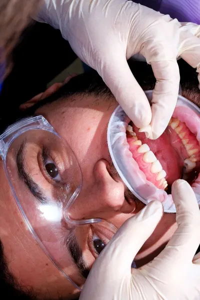Tipuri de materiale pentru o coroana dentara